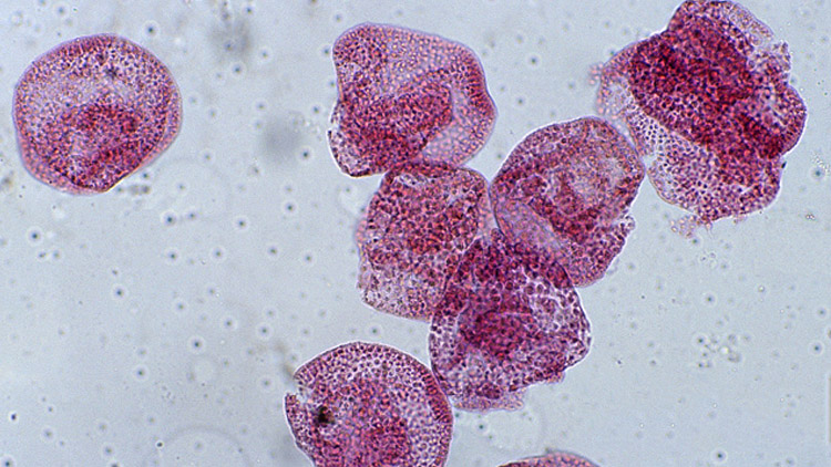 一个美丽的意外——活细胞的发现